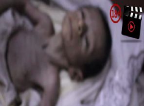 Suriyeli annelerin açlık dramı... (+18)