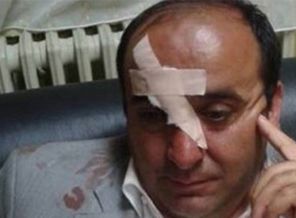 AK Partili Belediye Başkanını öldürüyorlardı