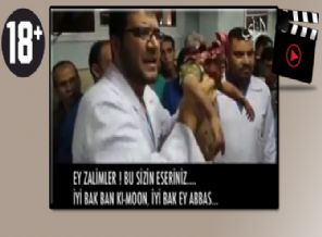 İsrail vahşeti doktorları bile isyan ettirdi (+18)