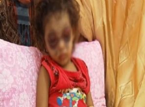 2,5 yaşındaki kızı bu hale getirdiler