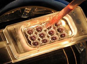 Ebola salgını 729 can aldı