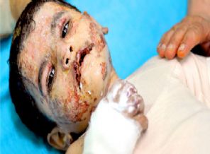 Yamen’in yürek burkan öyküsü