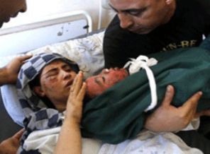 Gazzeli anneden dünyayı ağlatan fotoğraf