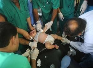 Gazze'de görevli doktorların ruh sağlığı bozuldu