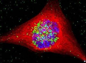 Kansere altın tedavi