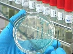 Osmaniye'de ebola şüphesi