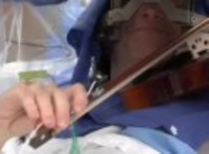 Beyin ameliyatında keman çaldı