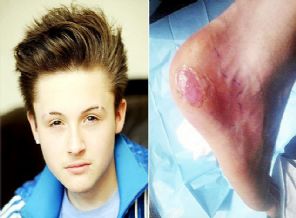 Yara bandı komaya soktu