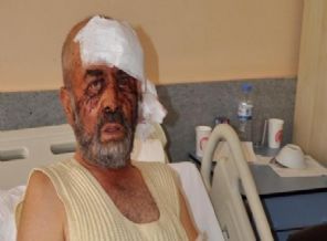 Kurt'la 15 dakika boğuştu