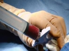 Kızılay artık ilik toplayacak