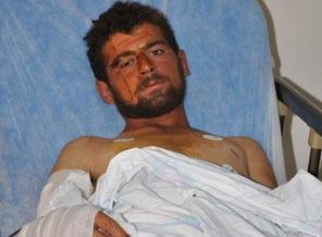 Ayı saldırısına uğrayan gencin mucize kurtuluşu