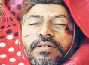 ABD Türkiyeli direnişçileri vurdu