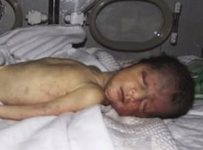 Esed rejimi klor gazı attı