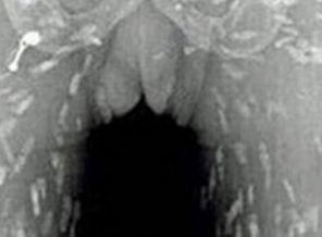 Doktorlar gözlerine inanamadı