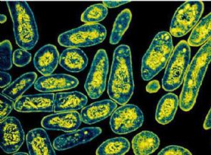 Nefesle verem testi geliştirildi