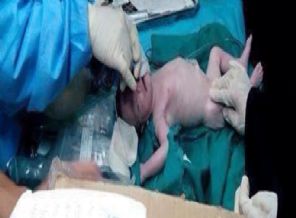 Şehit annenin karnından canlı bebek!