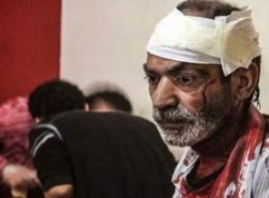 Suriye'de insanlık kıyımı devam ediyor: 41 ölü