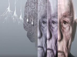 Gurbet bu hastalığı körüklüyor