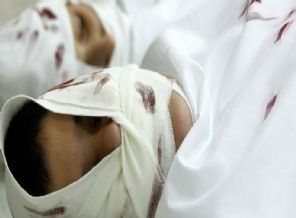 Müslümanların yüreğini sızlatacak Suriye gerçeği