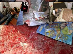 Okula ve öğrenci servisine bombalı saldırı