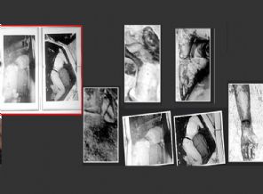 Aselsan mühendisinin olay yeri fotoğrafları