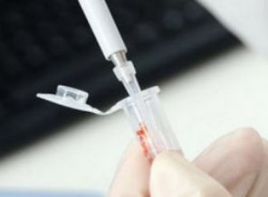 Kanada'da kuş gribi vakası