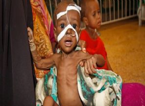 38 bin çocuk açlıktan ölebilir