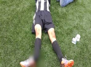 Dil boğaza kaçtı, ayak kırıldı ve maç yarım kaldı!