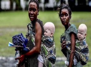 Büyü için öldürülüyorlar