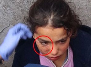 Suriyeli küçük kızın burnunu kırıp,paralarını almak istediler