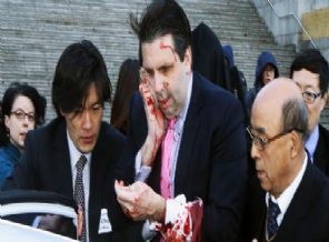 ABD Büyükelçisi'ne saldırı