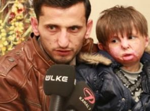 Minik Vehbi tedavi için Türkiye'ye geldi