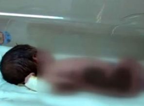 Yeni doğan bebeği 'Isıtacağız' diye yaktılar